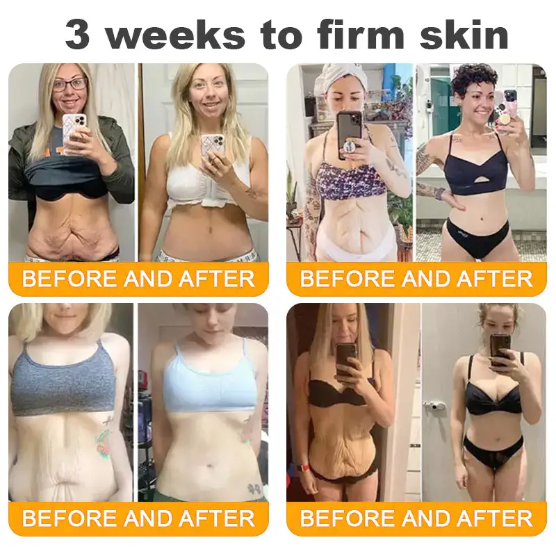 TLOPA® 💟Bee Venom Skin Restoration Cream ⏰ LAST DAY 80% OFF💌