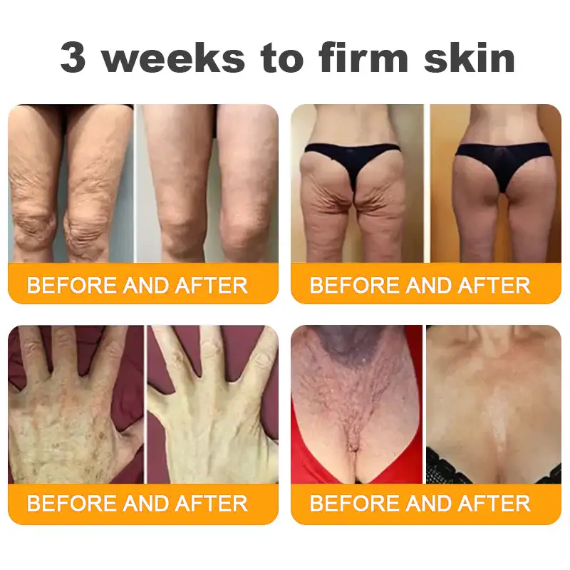 TLOPA® 💟Bee Venom Skin Restoration Cream ⏰ LAST DAY 80% OFF💌
