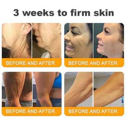 TLOPA® 💟Bee Venom Skin Restoration Cream ⏰ LAST DAY 80% OFF💌